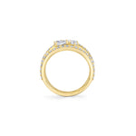 MICHAEL M Rings Montage Single Cluster Tension Band