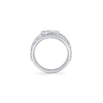 MICHAEL M Rings Montage Single Cluster Tension Band