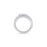 MICHAEL M Rings Montage Single Cluster Tension Band