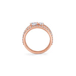 MICHAEL M Rings Montage Single Cluster Tension Band