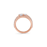 MICHAEL M Rings Montage Single Cluster Tension Band