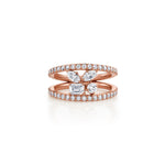 MICHAEL M Rings Montage Single Cluster Tension Band